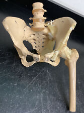 Vintage Anatomy Model of Pelvis Hip and Lumbar Spine with Nerves picture
